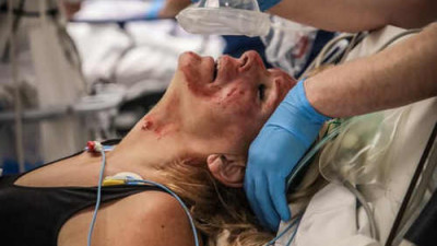 Slachtoffer met bloeddrukband om krijgt beademingsmasker in ziekenhuis