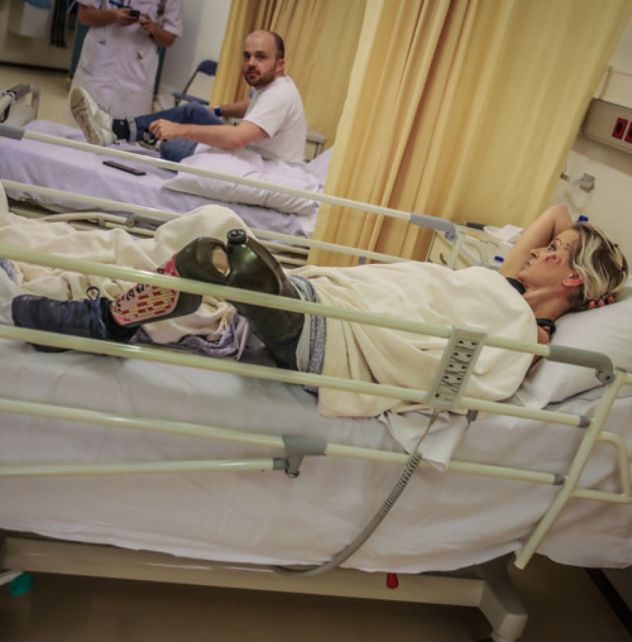 Actrice met beenprothese